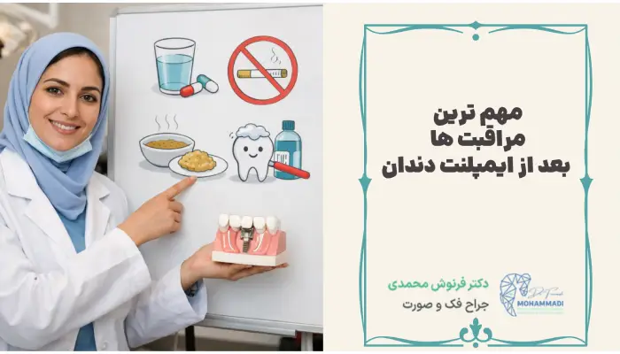 مهم ترین مراقبت ها بعد از ایمپلنت دندان