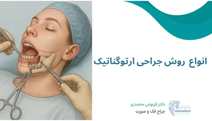 انواع جراحی ارتوگناتیک