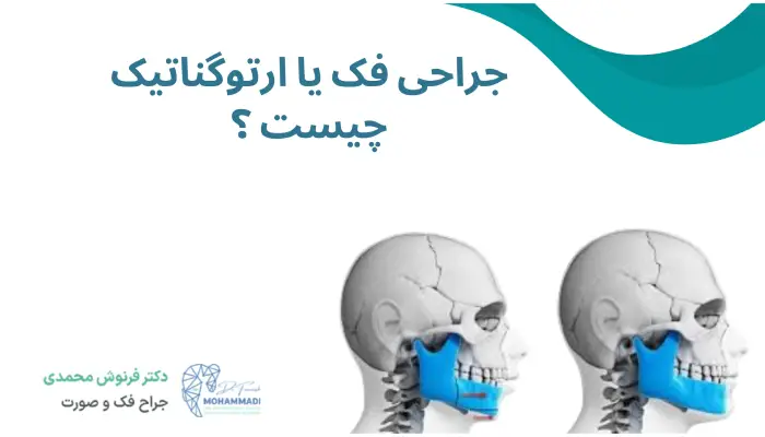 جراحی فک یا ارتوگناتیک چیست ؟