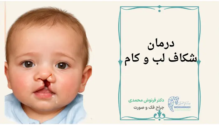 درمان
شکاف لب و کام