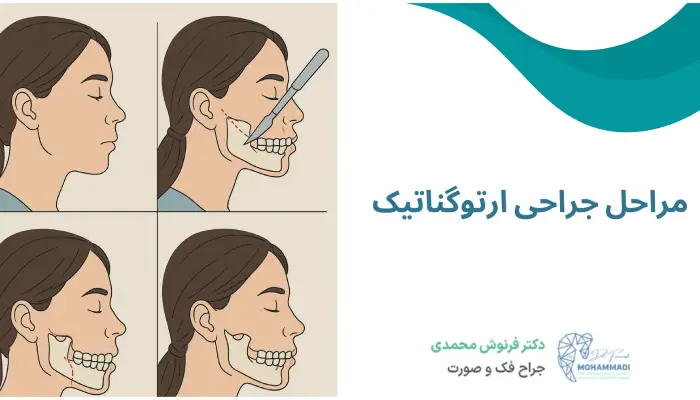 مراحل جراحی ارتوگناتیک