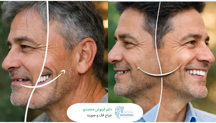 مزایای ایملپنت دندان
