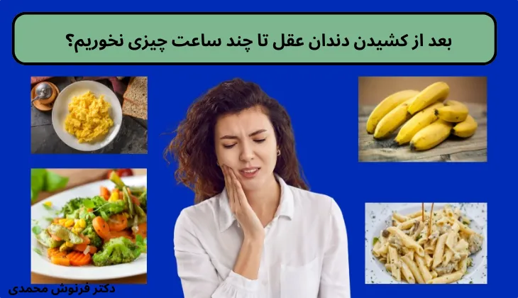 بعد از کشیدن دندان عقل تا چند ساعت چیزی نخوریم؟