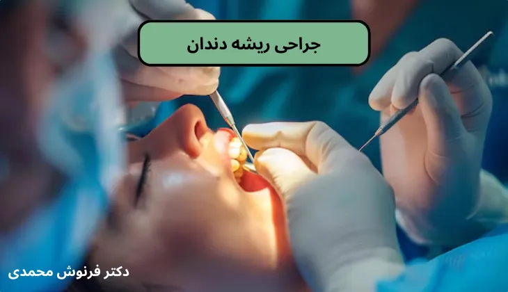 جراحی ریشه دندان