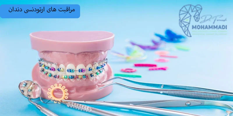 مراقبت-های-ارتودنسی