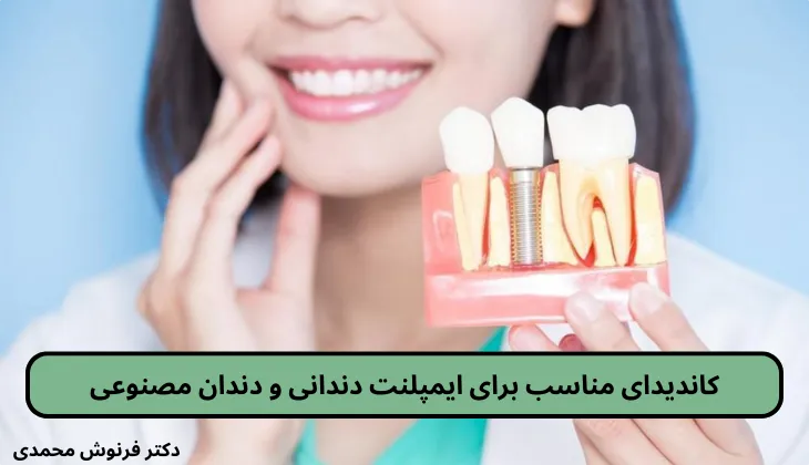 کاندیدای مناسب برای ایمپلنت دندانی و دندان مصنوعی