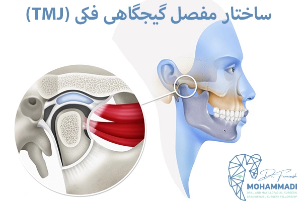 درد فک به دلیل اختلال در مفصل گیجگاهی