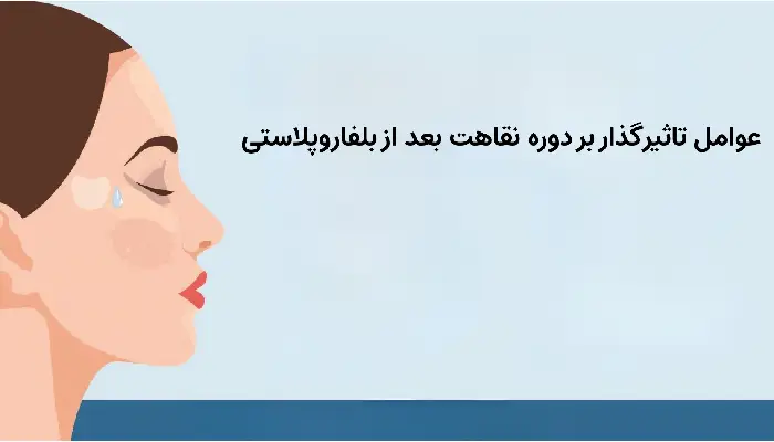 عوامل تاثیرگذار بر دوره نقاهت بعد از بلفاروپلاستی