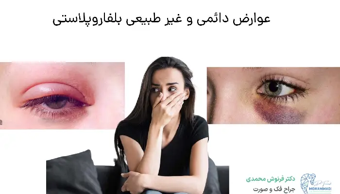 عوارض دائمی و غیر طبیعی بلفاروپلاستی