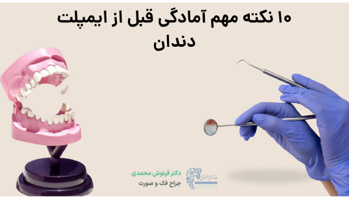10 نکته مهم آمادگی قبل از ایمپلت دندان