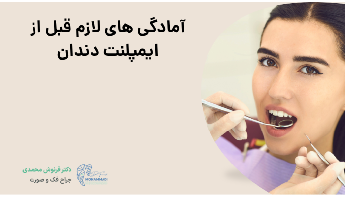 آمادگی های لازم قبل از ایمپلنت دندان