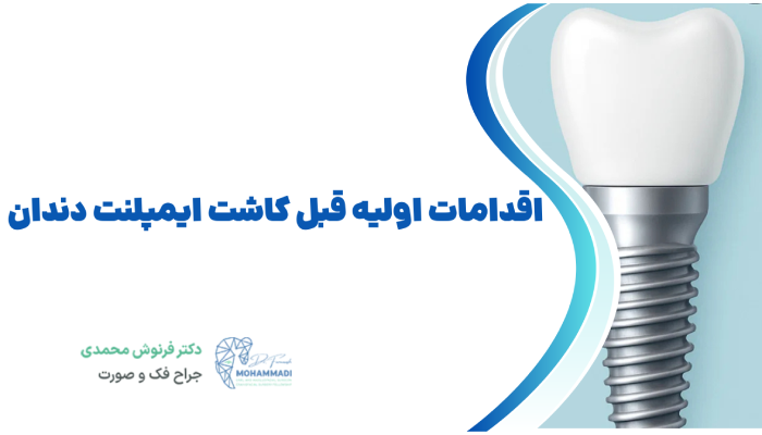 اقدامات اولیه قبل کاشت ایمپلنت دندان