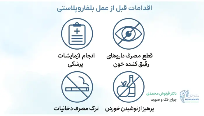 اقدامات قبل از عمل بلفاروپلاستی