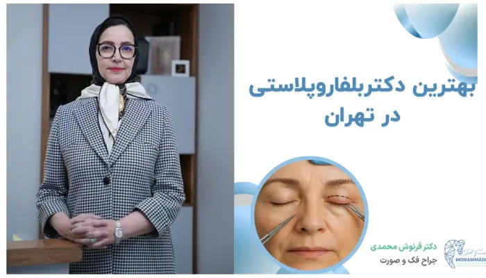 بهترین دکتربلفاروپلاستی در تهران
