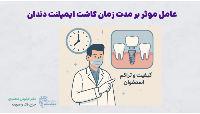 عامل موثر بر مدت زمان کاشت ایمپلنت دندان