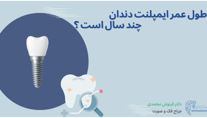 عمر ایمپلنت دندان چند سال است ؟