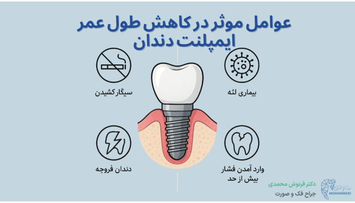 عوامل موثر در کاهش طول عمر ایمپلنت دندان