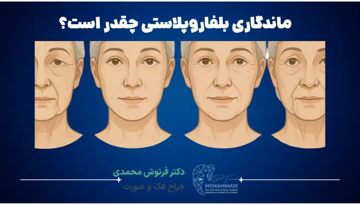 ماندگاری بلفاروپلاستی چقدر است؟