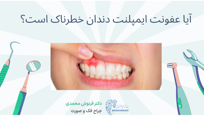 آیا عفونت ایمپلنت دندان خطرناک است؟