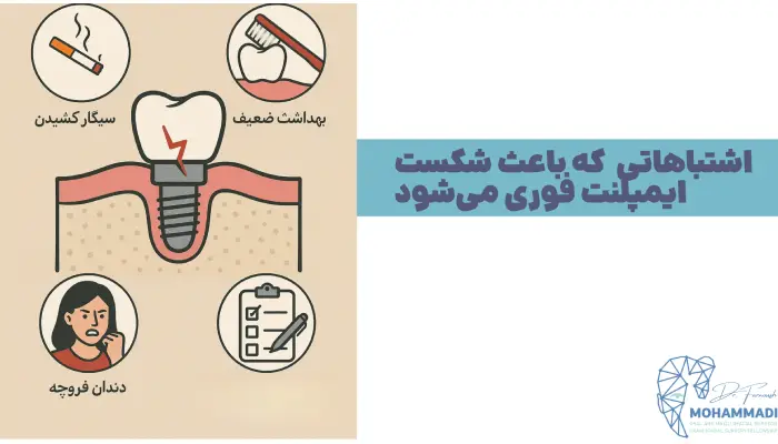 اشتباهاتی که باعث شکست
ایمپلنت فوری میشود