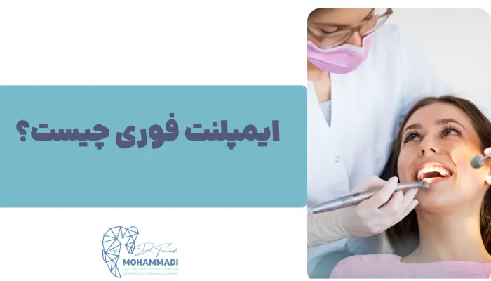 ایمپلنت فوری چیست؟