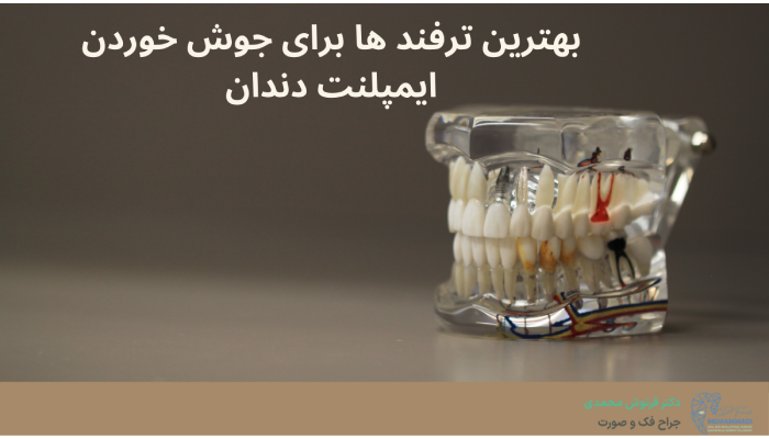 بهترین ترفند ها برای جوش خوردن ایمپلنت دندان