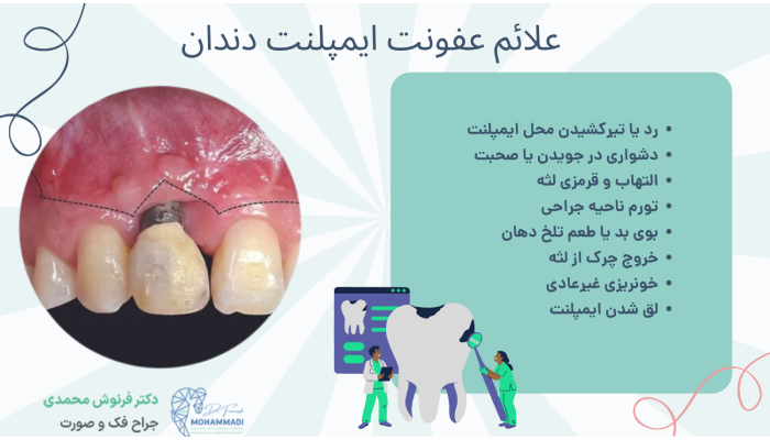 علائم عفونت ایمپلنت دندان