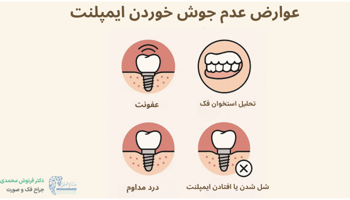 عوارض عدم جوش خوردن ایمپلنت