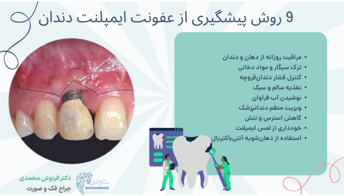 پیشگیری از عفونت ایمپلنت دندان