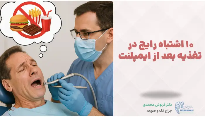 10 اشتباه رایج بیماران در تغذیه بعد از ایمپلنت