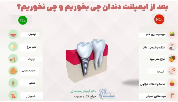 بعد از ایمپلنت دندان چی بخوریم و چی نخوریم؟