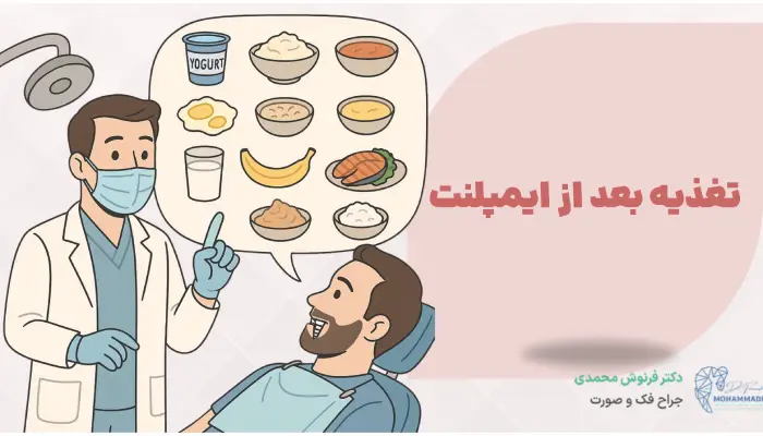 تغذیه بعد از ایمپلنت