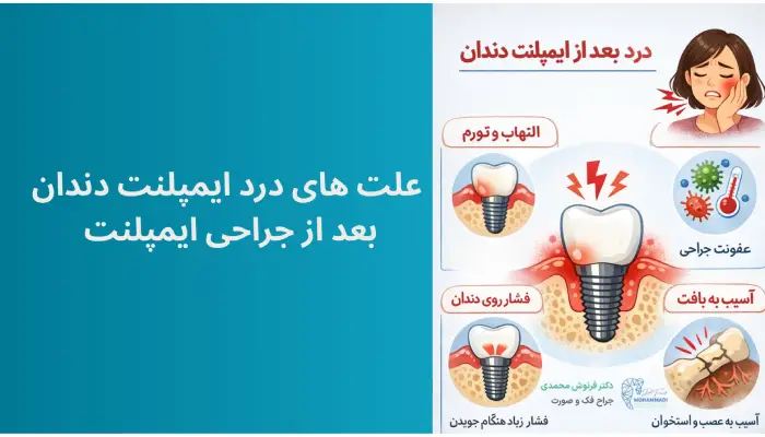 دلایل درد بعد از ایمپلنت دندان