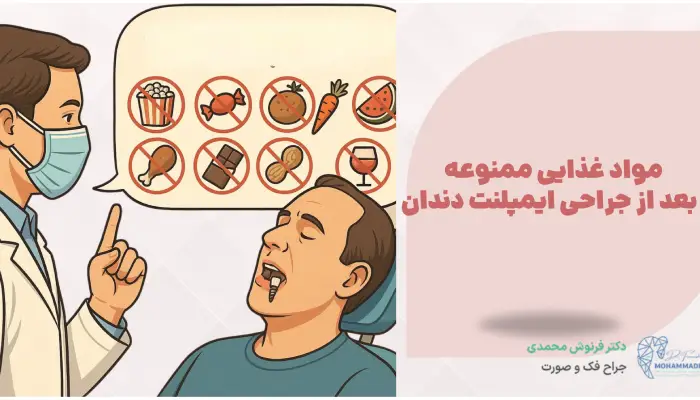 مواد غذایی ممنوعه بعد از جراحی ایمپلنت دندان