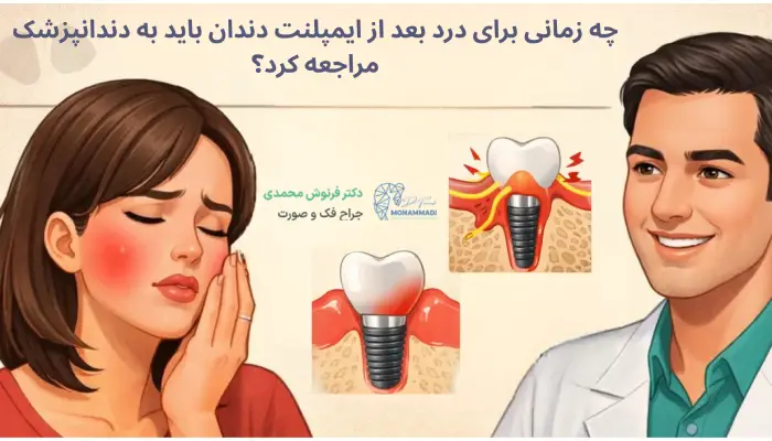 چه زمانی برای درد بعد از ایمپلنت دندان باید به دندانپزشک مراجعه کرد؟