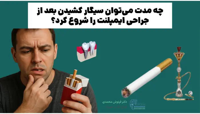 چه مدت میتوان سیگار کشیدن بعد از جراحی ایمپلنت را شروع کرد؟